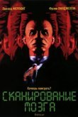  Сканирование мозга 